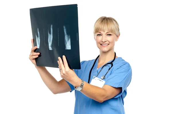 Dame chirurg bedrijf x-ray verslag — Stockfoto