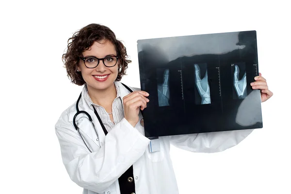 Fröhliche Ärztin begutachtet Röntgenbericht der Patienten — Stockfoto