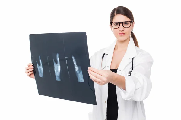 Médico joven examinando informe de rayos X del pulgar — Foto de Stock