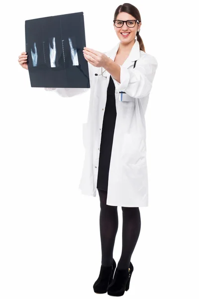 Female doctor reviewing patient's x-ray report — Stock Photo, Image