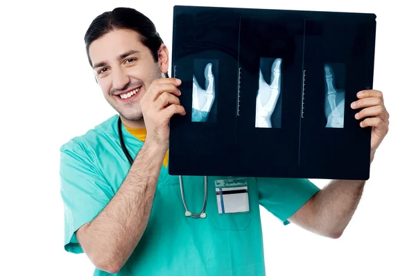 Wesoły lekarz trzymając kciuk rentgenowskie — Zdjęcie stockowe