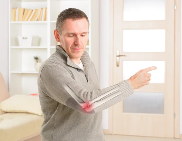 Painful elbow — Stock Photo, Image