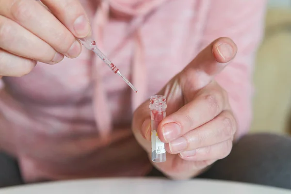 Kadın Covid19 Testi Yapmak Için Parmağından Bir Pipetle Kan Örneği — Stok fotoğraf