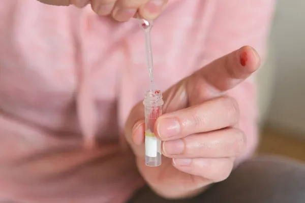 여성이 Covid19 검사를 손가락에서 피펫을 가지고 샘플을 스톡 이미지
