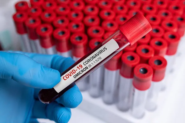 Doctor Blood Sample Covid Omicron 529 Variant General Data Covid — Stock Photo, Image