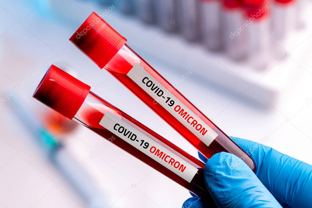 Doctor with blood sample of Covid-19 Omicron B.1.1.529 Variant and general data of covid-19 Coronavirus Mutations.