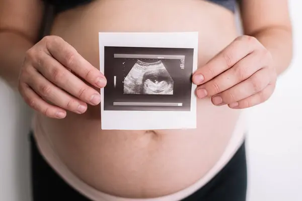 Mujer Embarazada Sosteniendo Ultrasonido Bebé — Foto de Stock