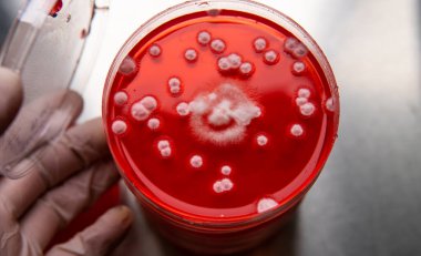 Küf ve bakterileri kırmızı agarlı bir petri kabında incelemek. Küf sporları ve mantar miselyumu