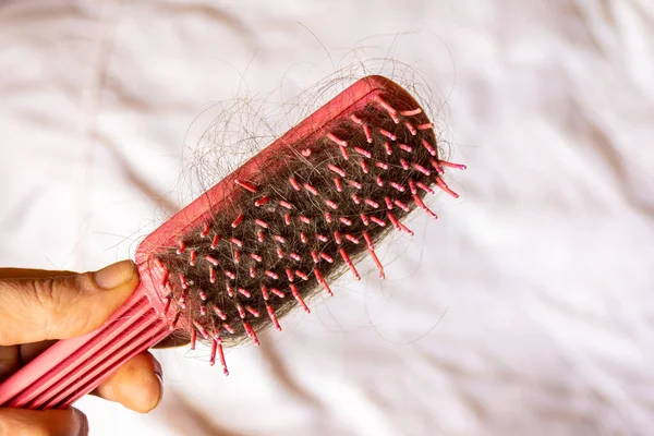 A man combed his hair and saw a lot of fallen dark and gray hair on a red comb, selective focus