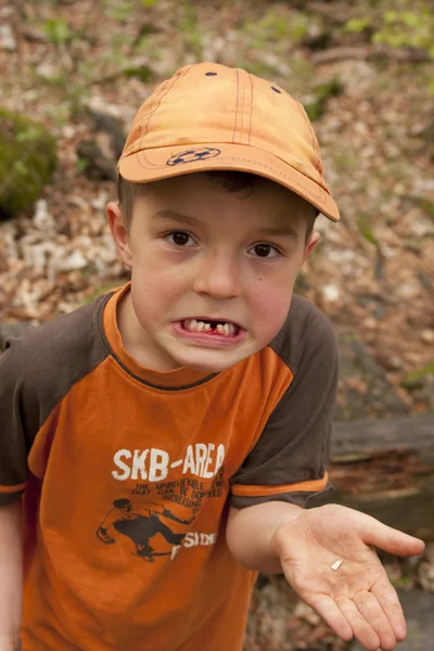 Boy without tooth. — Stock Photo, Image