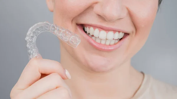 Close-up portret van een vrouw die een doorzichtige plastic beugel opzet. Een meisje corrigeert een beet met behulp van een orthodontisch apparaat — Stockfoto