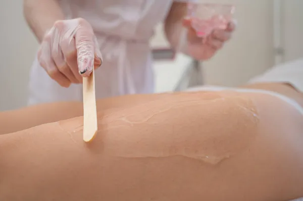 El maestro aplica el gel anestésico con una espátula a las piernas de las mujeres antes de la depilación láser. Depilación permanente con un dispositivo en la clínica — Foto de Stock