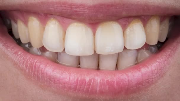 Крупный план женщины улыбается до и после отбеливания зубов. — стоковое видео