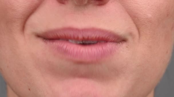 Close-up de uma mulher caucasiana sorrindo com alinhadores nos dentes. Macro. — Vídeo de Stock