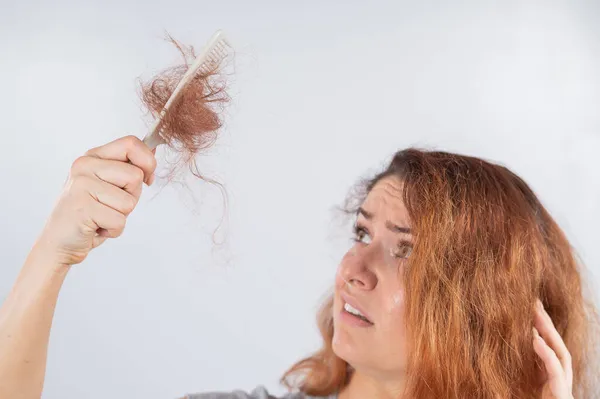 Mulher caucasiana com um sorriso de horror segura um pente com um pão de cabelo. Perda de cabelo e alopecia feminina. — Fotografia de Stock