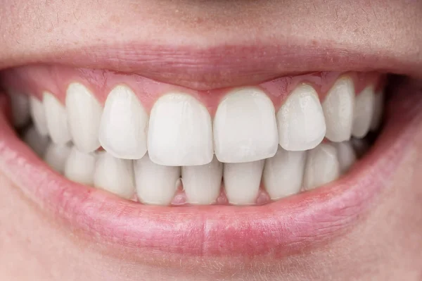 Primer plano de una sonrisa femenina perfecta. Macro. —  Fotos de Stock