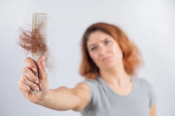 Donna caucasica con una smorfia di orrore tiene un pettine con una ciambella di capelli. Perdita di capelli e alopecia femminile. — Foto Stock