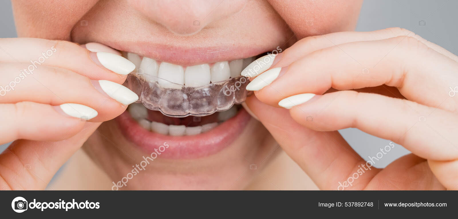 Closeup portrait of a woman putting on a transparent plastic retainer