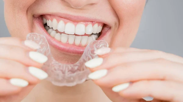 Close-up portrait of a woman putting on a transparent plastic retainer. A girl corrects a bite with the help of an orthodontic device — Stock Photo, Image