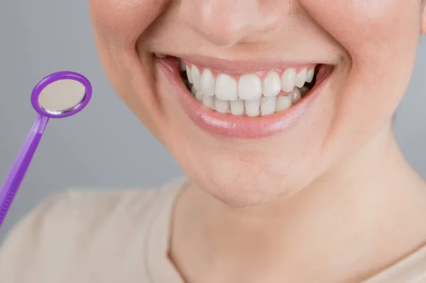 Vit kvinna med snövitt leende håller tandläkare spegel. — Stockfoto