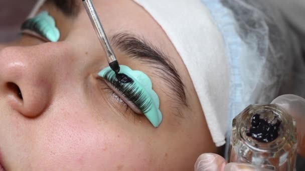 눈꺼풀 에염 증을 치료하고 있는 젊은 여자. — 비디오