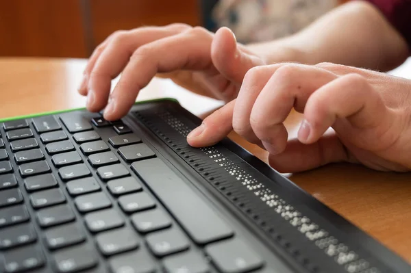 Um cego usa um computador com um monitor Braille e um teclado de computador. Dispositivo inclusivo. — Fotografia de Stock