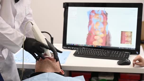 23.11.2021Russland, Nowosibirsk: Der Zahnarzt scannt den Kiefer des Patienten und demonstriert ein 3D-Modell. — Stockvideo