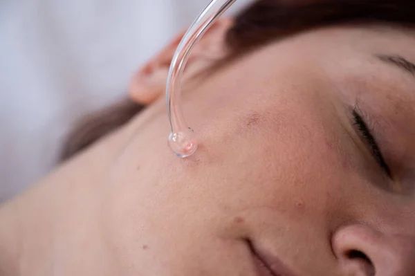 El médico utiliza el aparato darsonval contra el acné en la cara de una paciente femenina. — Foto de Stock