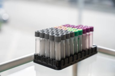 Kozmetoloji bürosundaki bir standın üzerinde gözkapakları olan test tüpleri.