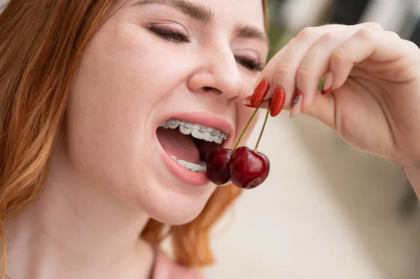 Vacker Ung Rödhårig Kvinna Med Tandställning Tänderna Äter Söta Körsbär — Stockfoto