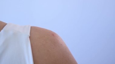 Doktor, kadın bir hastanın omzundaki sivilcelere karşı darsonval aparatı kullanıyor.