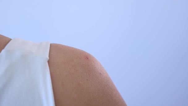 Arts Gebruikt Het Darsonval Apparaat Tegen Acne Schouder Van Een — Stockvideo