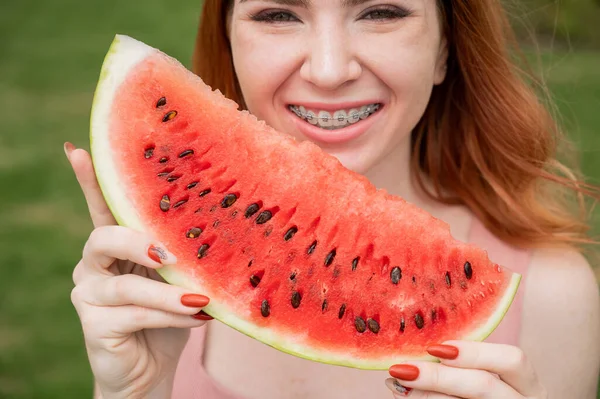 Beautiful Red Haired Woman Smiling Braces Eat Slice Watermelon Outdoors — Stock Photo, Image