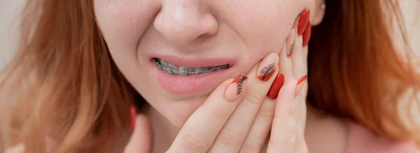 Genç Kızıl Saçlı Diş Telleri Olan Acı Çeken Bir Kadın — Stok fotoğraf