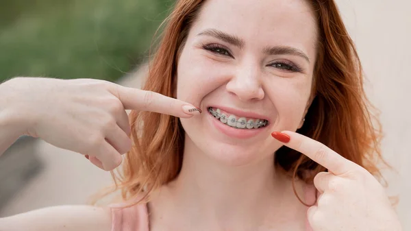 Joven Mujer Pelirroja Con Frenillos Los Dientes Apuntan Una Sonrisa — Foto de Stock