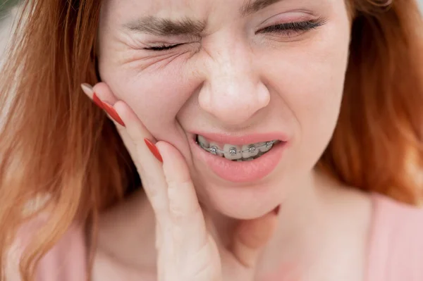 Mujer Joven Pelirroja Con Frenos Que Sufren Dolor — Foto de Stock