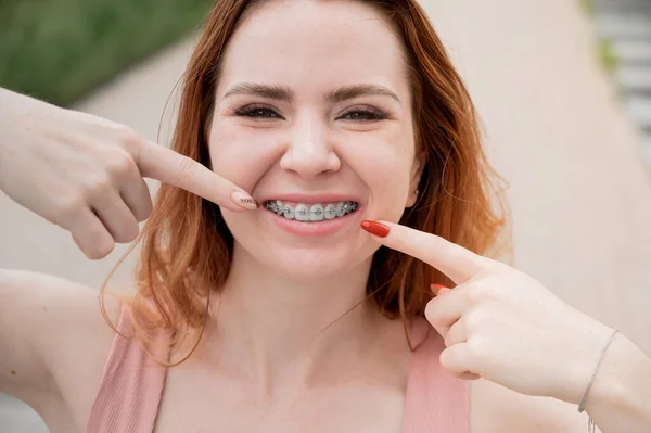 Jovem Ruiva Mulher Com Aparelho Nos Dentes Apontam Para Sorriso — Fotografia de Stock