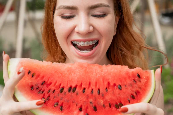 Beautiful Red Haired Woman Smiling Braces Eat Slice Watermelon Outdoors — Stock Photo, Image