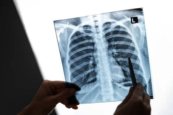 Médico Mostrando Raio Dos Pulmões Dos Pacientes — Fotografia de Stock