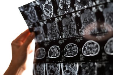 Kadın bir doktor iç organların MR taramasını inceliyor. Karnı.