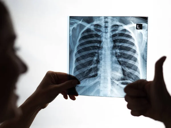 Médico Olha Para Radiografia Dos Pulmões Dos Pacientes Mostra Polegar — Fotografia de Stock