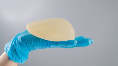 Eldivenli bir kadın eli gri arka planda gözyaşı şeklinde bir göğüs implantı tutuyor.