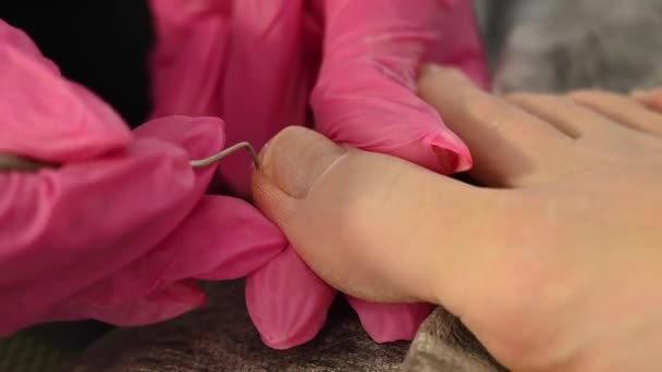 儿科医生给病人做足疗 主人用金属棒对脚趾进行卫生 — 图库视频影像