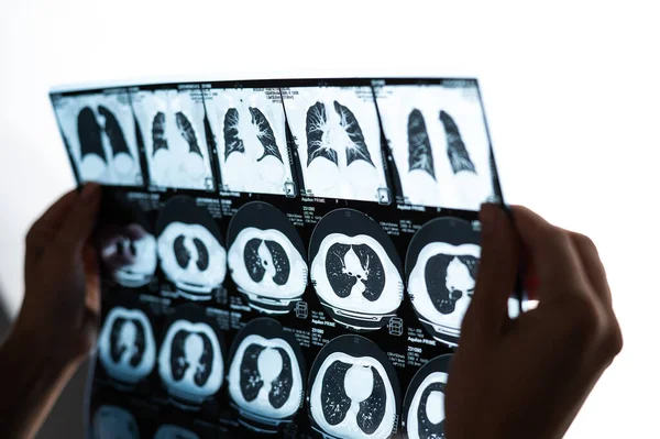 Uma Médica Examina Uma Ressonância Magnética Dos Órgãos Internos Abdómen — Fotografia de Stock