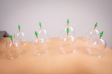 Kadın masaj terapisti hastaların sırtında süpürge kullanıyor.