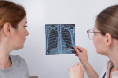 Doktor beyaz bir kadına danışıyor ve akciğerlerin röntgenleri hakkında yorum yapıyor.