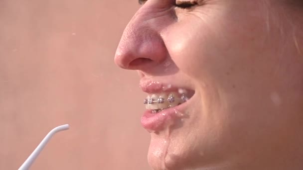 Uma Mulher Com Aparelho Nos Dentes Usa Irrigador — Vídeo de Stock