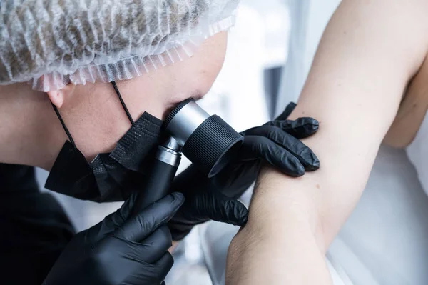 Hudläkare Undersöker Patient Mullvad Genom Ett Dermatoskop — Stockfoto