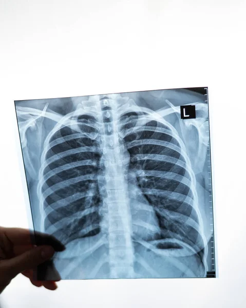 Médico Mostrando Raio Dos Pulmões Dos Pacientes — Fotografia de Stock