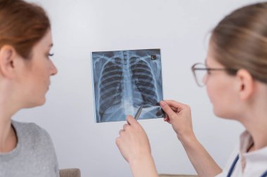 Doktor beyaz bir kadına danışıyor ve akciğerlerin röntgenleri hakkında yorum yapıyor.